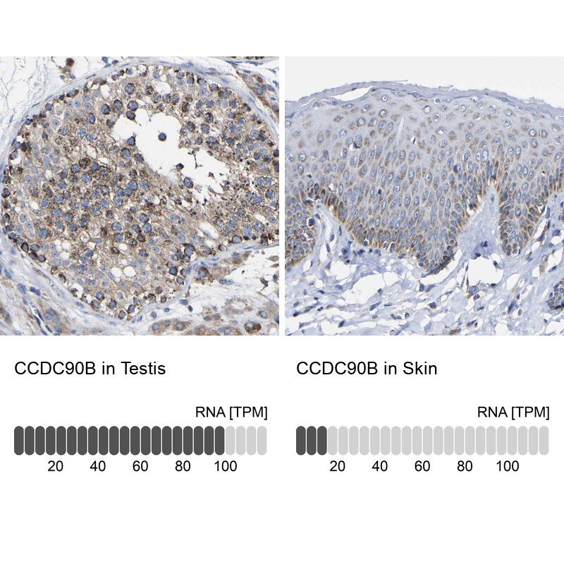 CCDC90B Antibody - BSA Free Immunohistochemistry: CCDC90B Antibody - BSA Free [NBP1-93529]