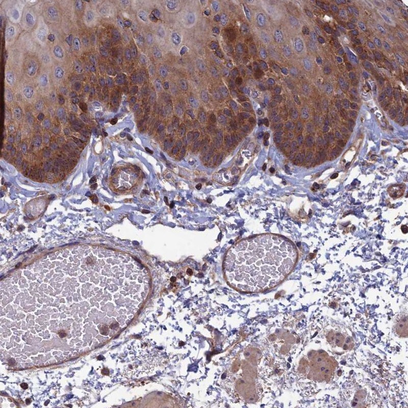 C15orf62 Antibody - BSA Free Immunohistochemistry: C15orf62 Antibody - BSA Free [NBP1-93538]