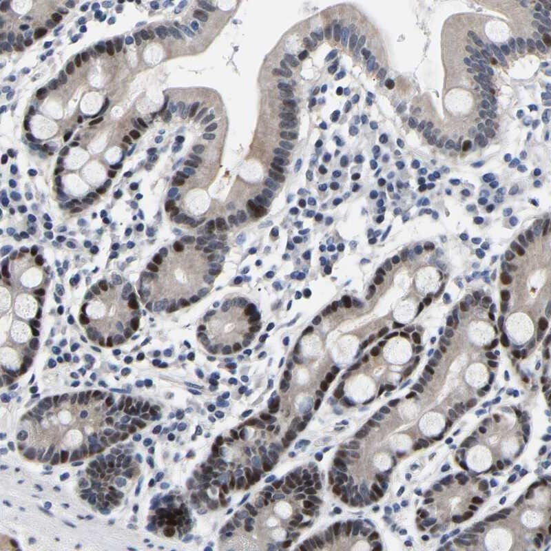 PTRHD1 Antibody - BSA Free Immunohistochemistry-Paraffin: PTRHD1 Antibody [NBP1-93543]
