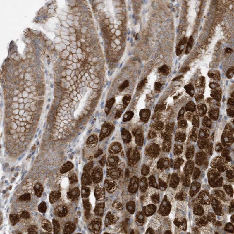 C2orf74 Antibody - BSA Free Immunohistochemistry: C2orf74 Antibody - BSA Free [NBP1-93548]