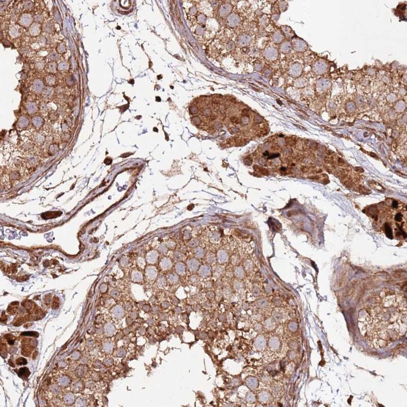 FAM186A Antibody - BSA Free Immunohistochemistry: FAM186A Antibody - BSA Free [NBP1-93553]