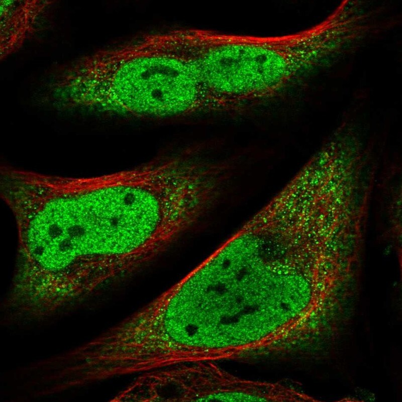 CCDC152 Antibody - BSA Free Immunocytochemistry/ Immunofluorescence: CCDC152 Antibody [NBP1-93555]