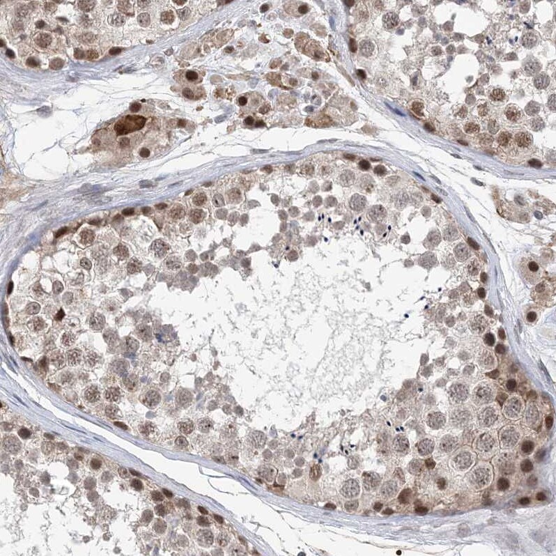 CCDC152 Antibody - BSA Free Immunohistochemistry: CCDC152 Antibody - BSA Free [NBP1-93555]