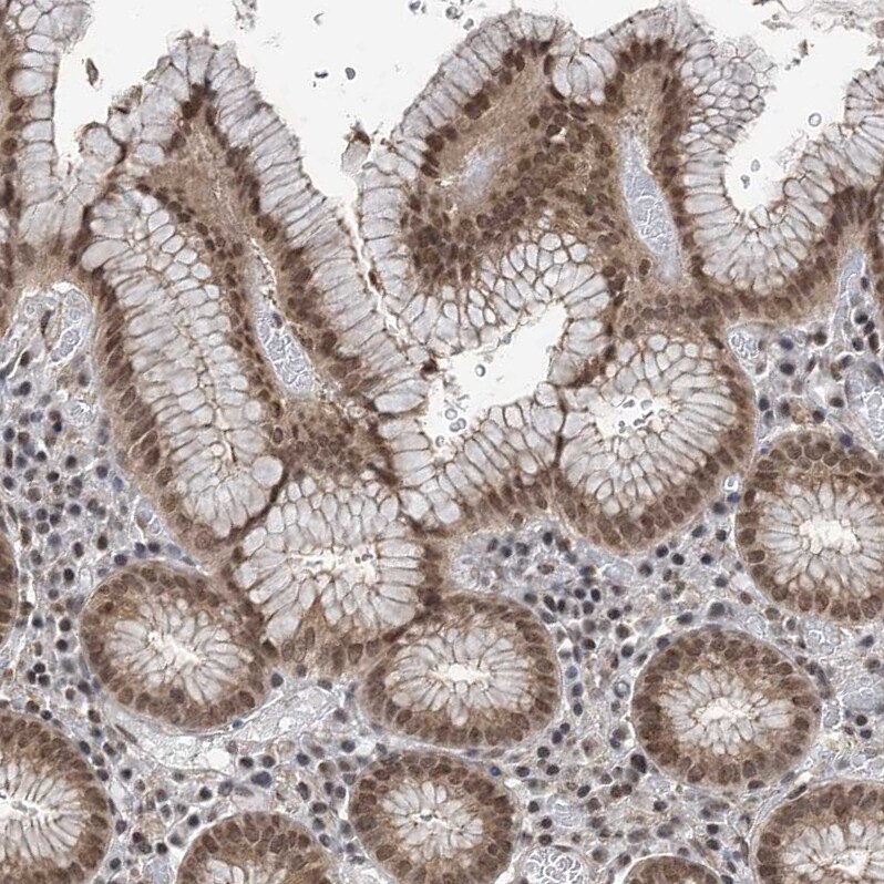 CCDC152 Antibody - BSA Free Immunohistochemistry: CCDC152 Antibody - BSA Free [NBP1-93555]