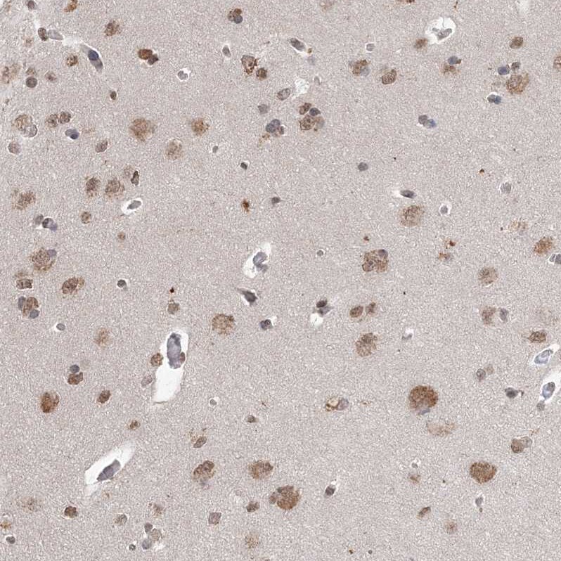 CCDC152 Antibody - BSA Free Immunohistochemistry: CCDC152 Antibody - BSA Free [NBP1-93555]