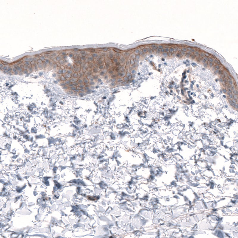LRRC15 Antibody - BSA Free Immunohistochemistry: LRRC15 Antibody - BSA Free [NBP1-93556]