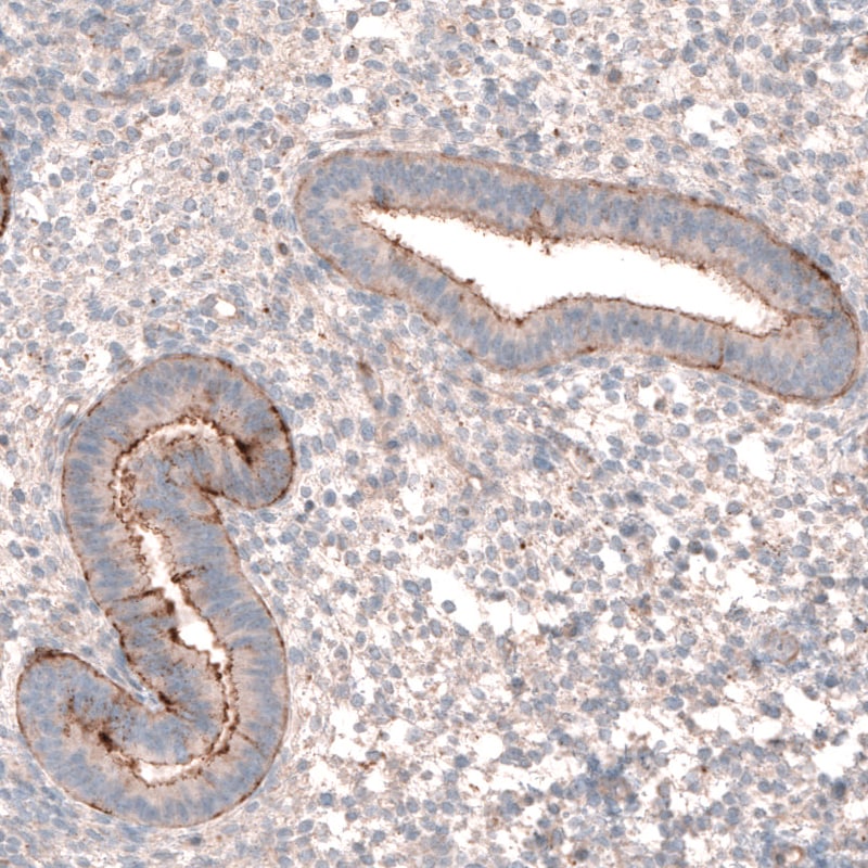 LRRC15 Antibody - BSA Free Immunohistochemistry: LRRC15 Antibody - BSA Free [NBP1-93556]