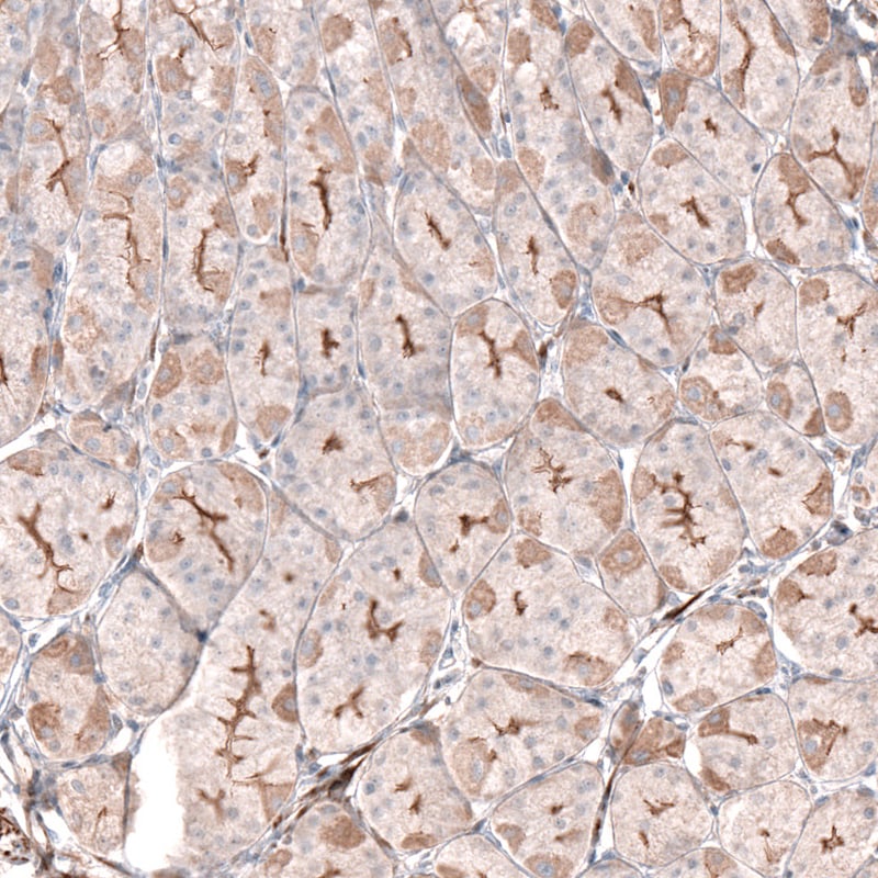 LRRC15 Antibody - BSA Free Immunohistochemistry: LRRC15 Antibody - BSA Free [NBP1-93556]