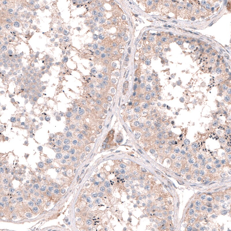 LRRC15 Antibody - BSA Free Immunohistochemistry: LRRC15 Antibody - BSA Free [NBP1-93556]