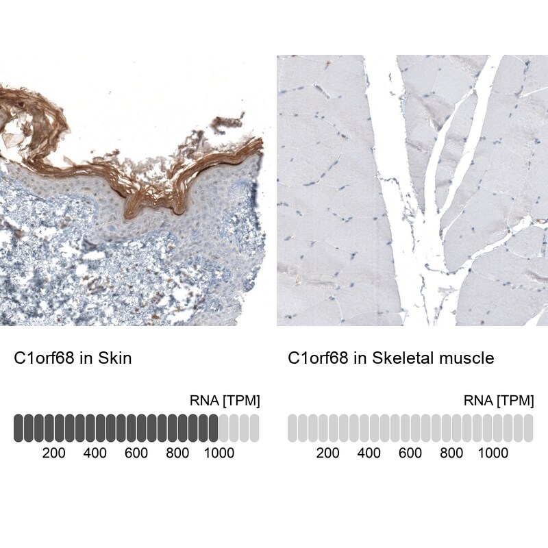XP32 Antibody - BSA Free Immunohistochemistry: XP32 Antibody - BSA Free [NBP1-93557]