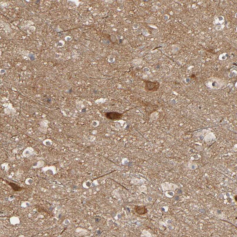 SGSM1 Antibody - BSA Free Immunohistochemistry: SGSM1 Antibody - BSA Free [NBP1-93564]