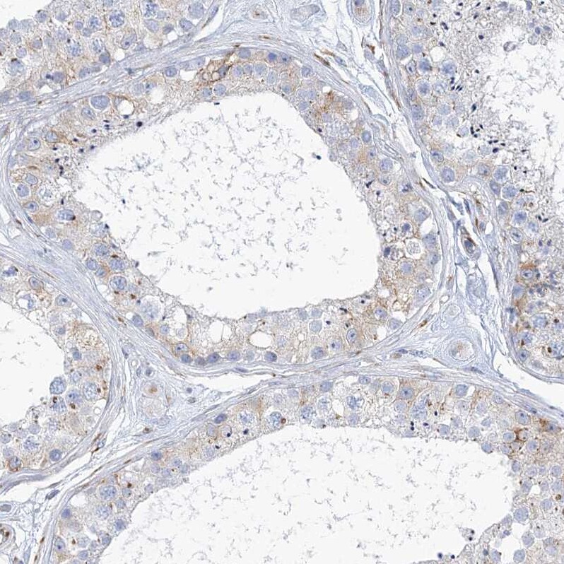 PLEKHG4B Antibody - BSA Free Immunohistochemistry: PLEKHG4B Antibody - BSA Free [NBP1-93566]