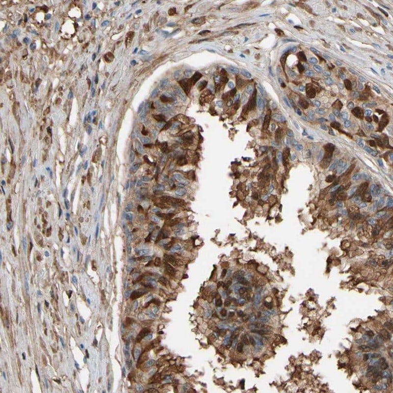 CSMD2 Antibody - BSA Free Immunohistochemistry: CSMD2 Antibody - BSA Free [NBP1-93569]