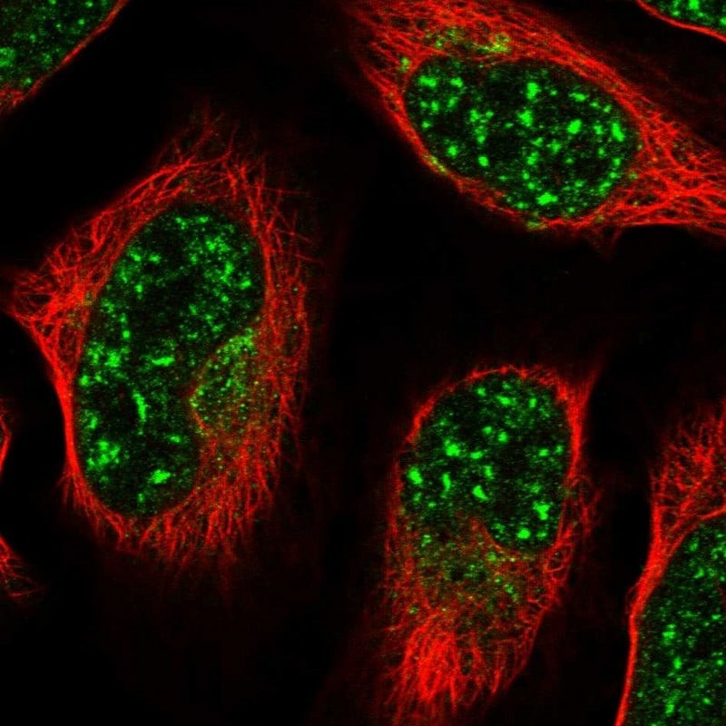 ZNF527 Antibody - BSA Free Immunocytochemistry/ Immunofluorescence: ZNF527 Antibody [NBP1-93572]