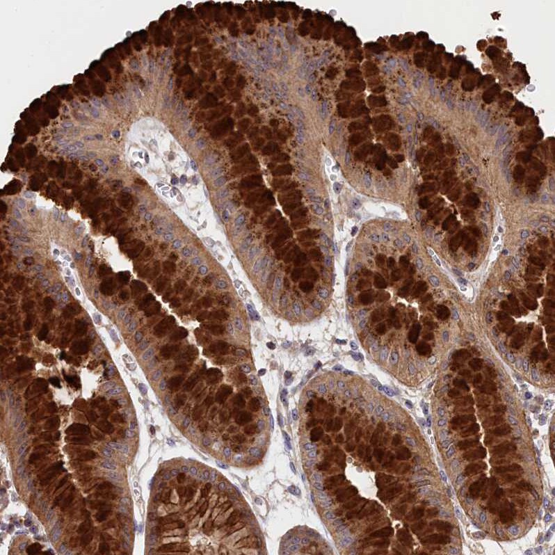 NEURL4 Antibody - BSA Free Immunohistochemistry: NEURL4 Antibody - BSA Free [NBP1-93574]