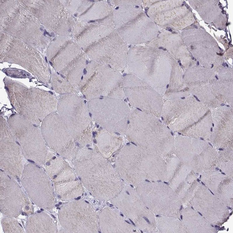 TSPYL5 Antibody - BSA Free Immunohistochemistry: TSPYL5 Antibody - BSA Free [NBP1-93578]