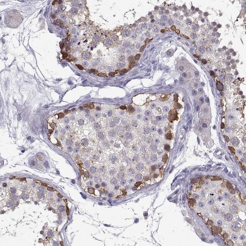 TSPYL5 Antibody - BSA Free Immunohistochemistry: TSPYL5 Antibody - BSA Free [NBP1-93578]