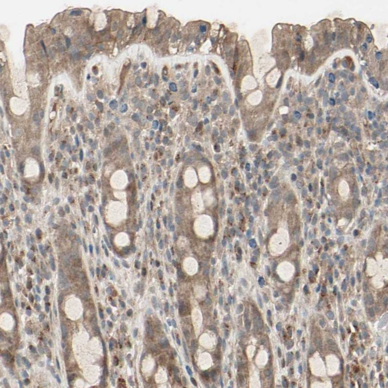 FHDC1 Antibody - BSA Free Immunohistochemistry: FHDC1 Antibody - BSA Free [NBP1-93579]