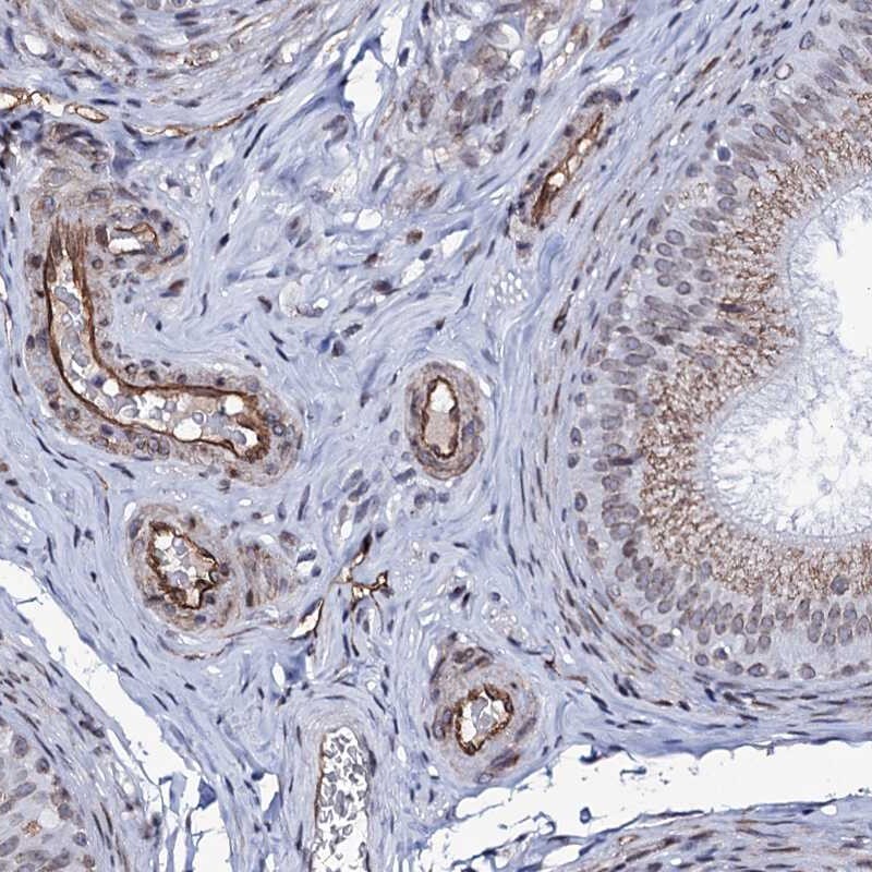 ZC3H12C Antibody - BSA Free Immunohistochemistry-Paraffin: ZC3H12C Antibody [NBP1-93580]