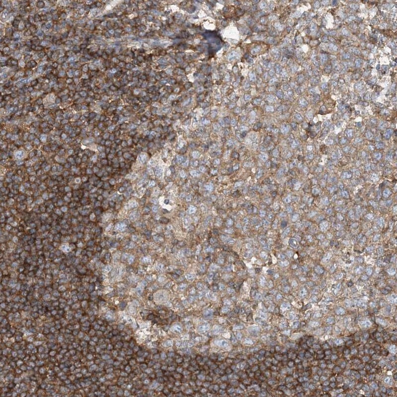 SFMBT2 Antibody - BSA Free Immunohistochemistry-Paraffin: SFMBT2 Antibody [NBP1-93582]