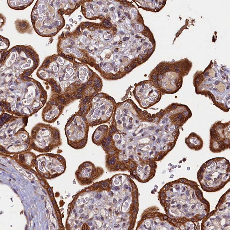 NCKAP5L Antibody - BSA Free Immunohistochemistry: NCKAP5L Antibody - BSA Free [NBP1-93583]