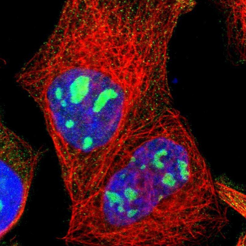 LRCH2 Antibody - BSA Free Immunocytochemistry/ Immunofluorescence: LRCH2 Antibody [NBP1-93588]