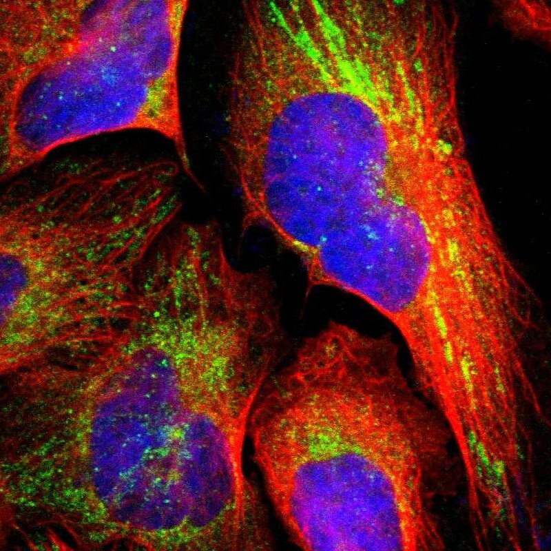 TXNDC16 Antibody - BSA Free Immunocytochemistry/ Immunofluorescence: TXNDC16 Antibody [NBP1-93591]