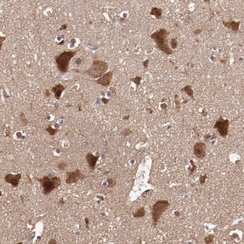 TXNDC16 Antibody - BSA Free Immunohistochemistry: TXNDC16 Antibody - BSA Free [NBP1-93591]