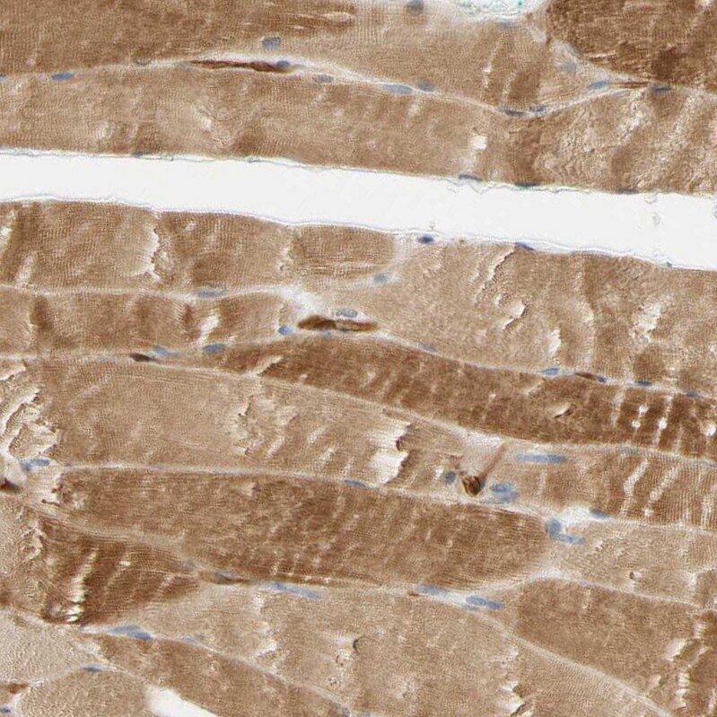 PARP14 Antibody - BSA Free Immunohistochemistry: PARP14 Antibody - BSA Free [NBP1-93592]