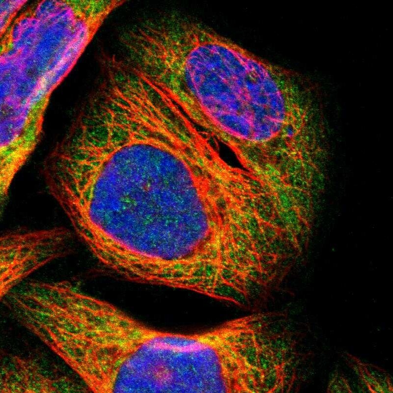 PARP14 Antibody - BSA Free Immunocytochemistry/ Immunofluorescence: PARP14 Antibody - BSA Free [NBP1-93592]