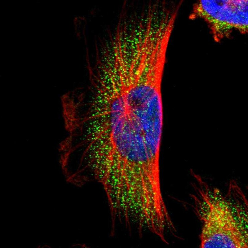 PARP14 Antibody - BSA Free Immunocytochemistry/ Immunofluorescence: PARP14 Antibody [NBP1-93593]