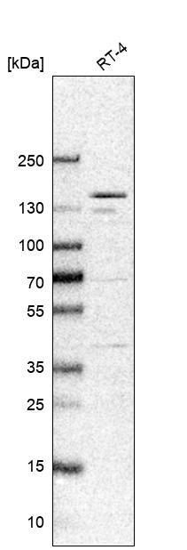 ANKRD50 Antibody - BSA Free Western Blot: ANKRD50 Antibody - BSA Free [NBP1-93594]