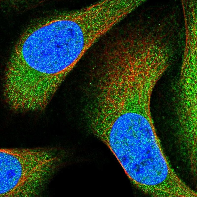 ANKRD50 Antibody - BSA Free Immunocytochemistry/ Immunofluorescence: ANKRD50 Antibody - BSA Free [NBP1-93594]