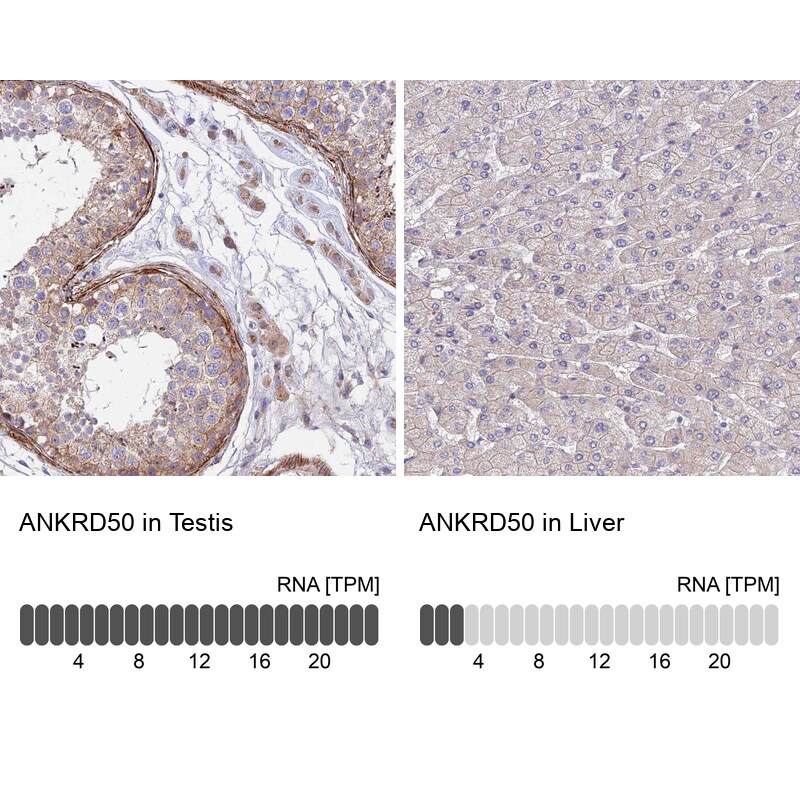 ANKRD50 Antibody - BSA Free Immunohistochemistry: ANKRD50 Antibody - BSA Free [NBP1-93594]