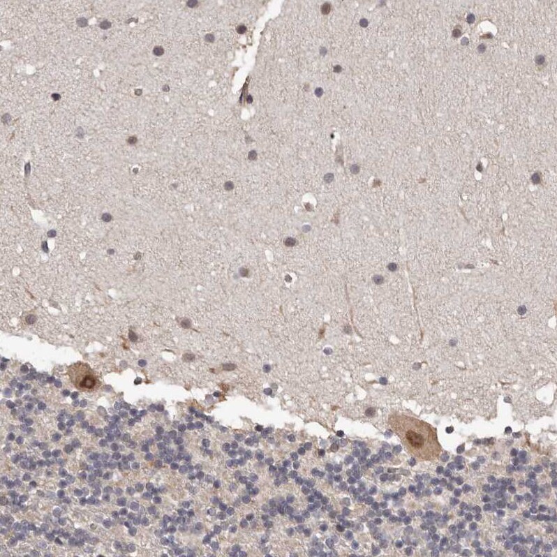 PRR12 Antibody - BSA Free Immunohistochemistry: PRR12 Antibody - BSA Free [NBP1-93595]