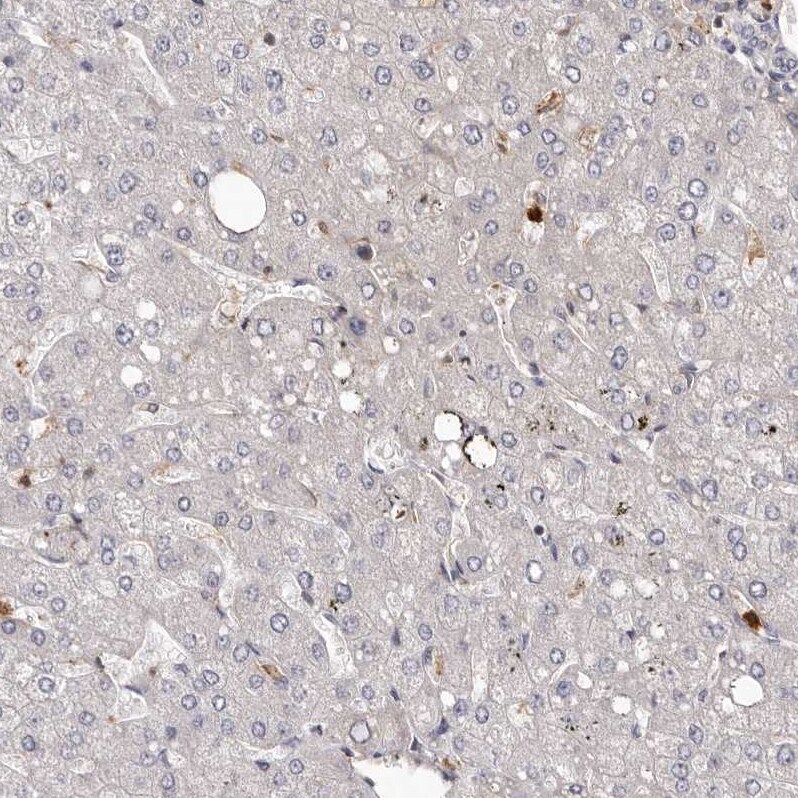 PRR12 Antibody - BSA Free Immunohistochemistry: PRR12 Antibody - BSA Free [NBP1-93595]