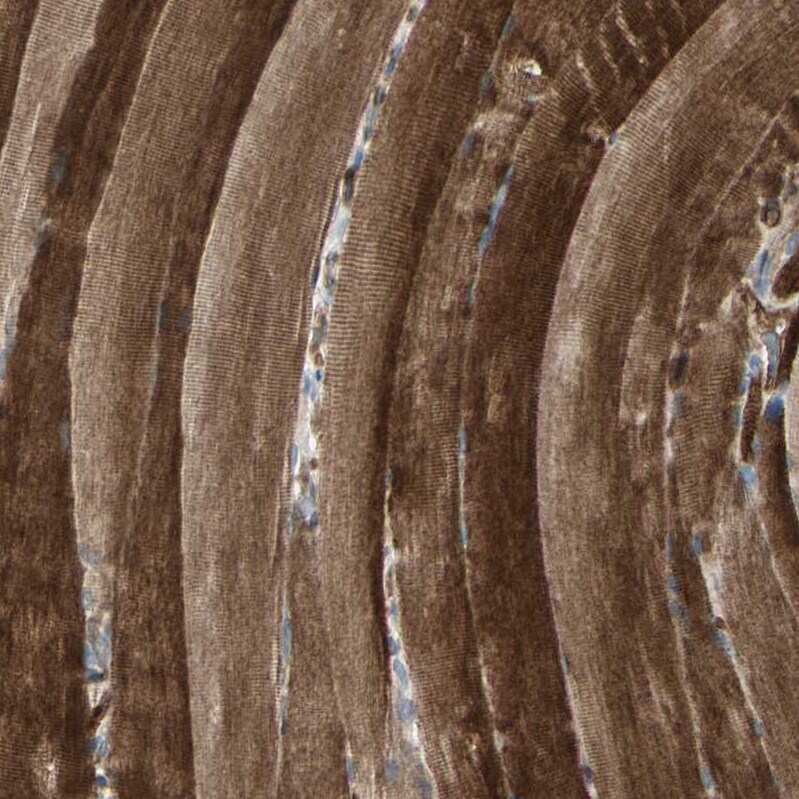 IGSF9B Antibody - BSA Free Immunohistochemistry: IGSF9B Antibody - BSA Free [NBP1-93608]