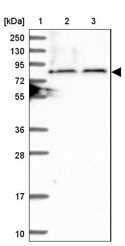 TBC1D30 Antibody - BSA Free Western Blot: TBC1D30 Antibody - BSA Free [NBP1-93610]