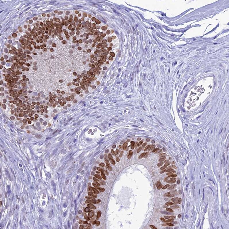 FAM169A Antibody - BSA Free Immunohistochemistry: FAM169A Antibody - BSA Free [NBP1-93616]