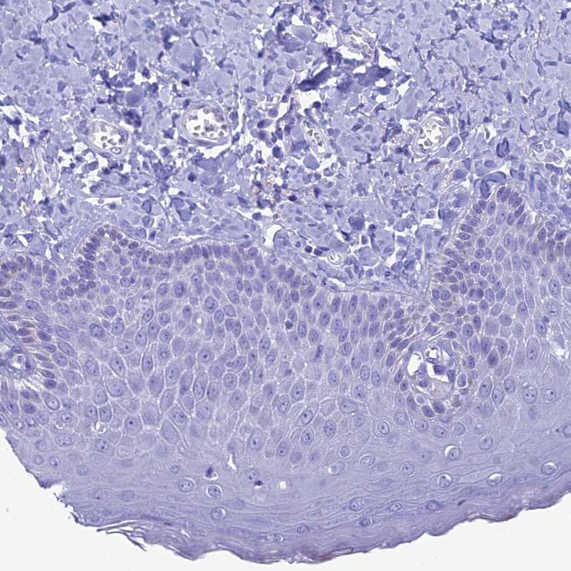 FAM169A Antibody - BSA Free Immunohistochemistry: FAM169A Antibody - BSA Free [NBP1-93616]
