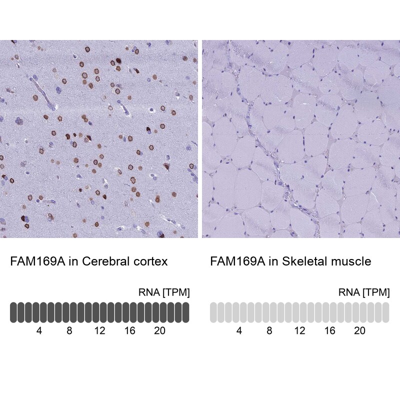 FAM169A Antibody - BSA Free Immunohistochemistry: FAM169A Antibody - BSA Free [NBP1-93616]