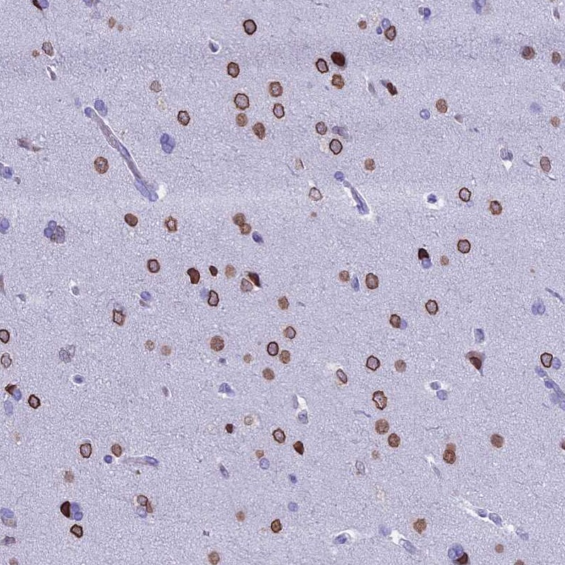 FAM169A Antibody - BSA Free Immunohistochemistry: FAM169A Antibody - BSA Free [NBP1-93616]