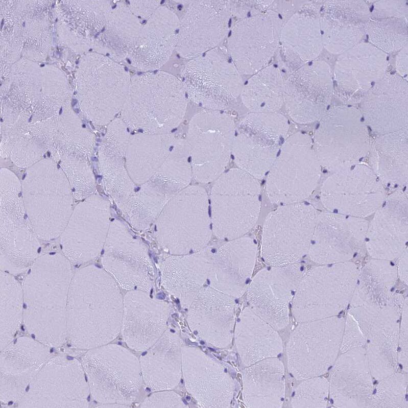 FAM169A Antibody - BSA Free Immunohistochemistry: FAM169A Antibody - BSA Free [NBP1-93616]