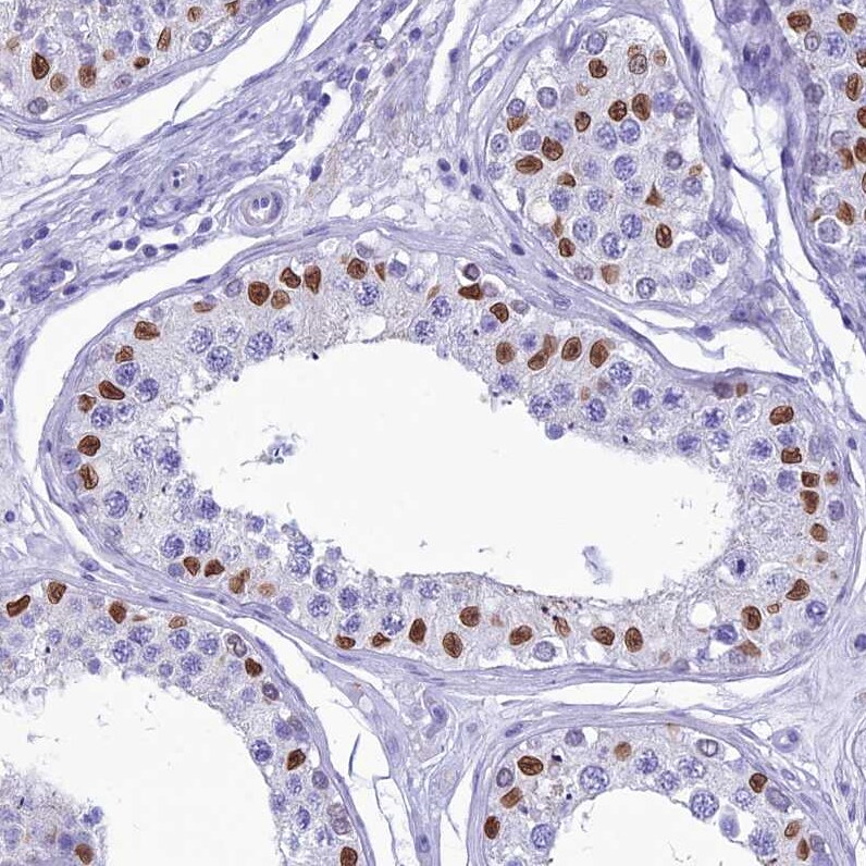 FAM169A Antibody - BSA Free Immunohistochemistry: FAM169A Antibody - BSA Free [NBP1-93616]