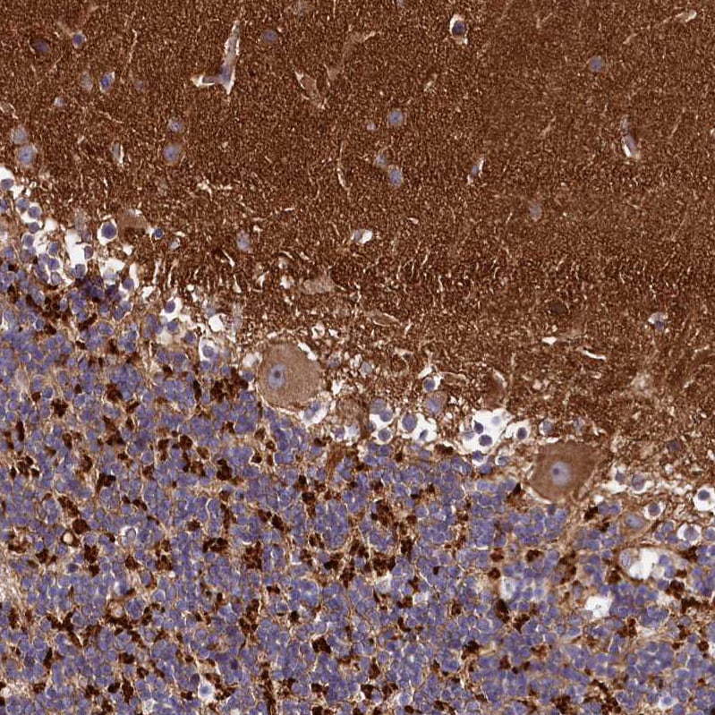 DMXL2 Antibody - BSA Free Immunohistochemistry: DMXL2 Antibody - BSA Free [NBP1-93618]