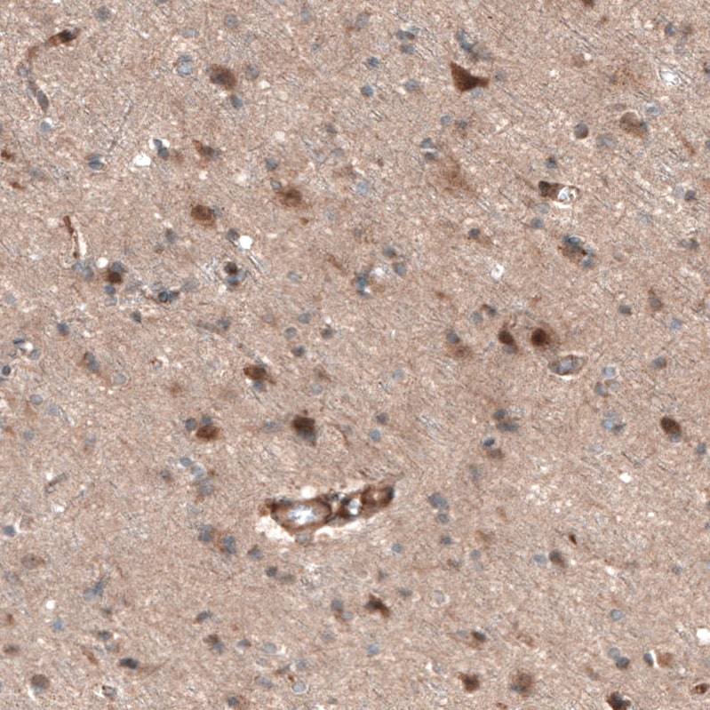 CAMTA1 Antibody - BSA Free Immunohistochemistry: CAMTA1 Antibody - BSA Free [NBP1-93620]