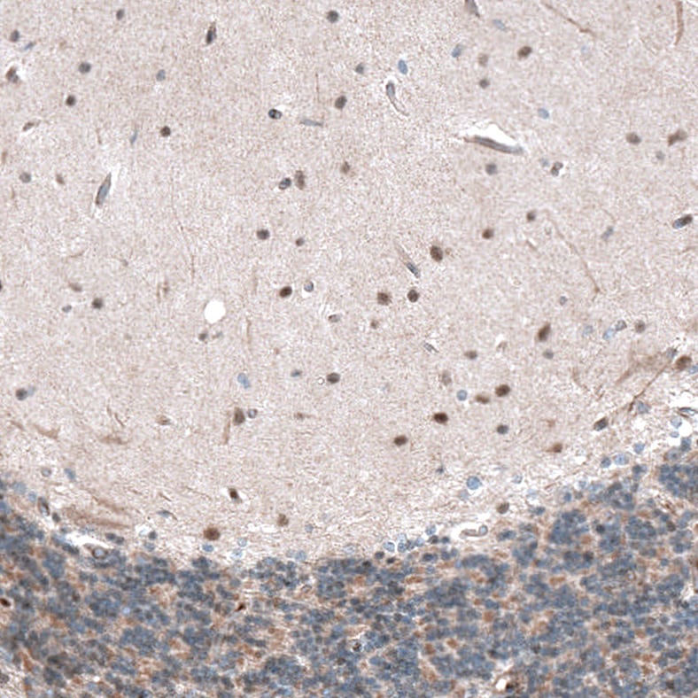 CAMTA1 Antibody - BSA Free Immunohistochemistry: CAMTA1 Antibody - BSA Free [NBP1-93620]