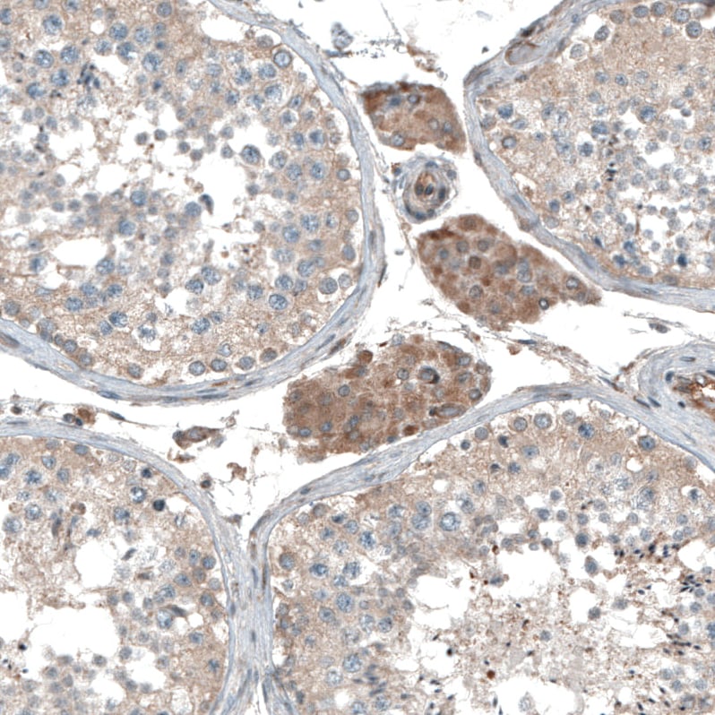 CAMTA1 Antibody - BSA Free Immunohistochemistry: CAMTA1 Antibody - BSA Free [NBP1-93620]