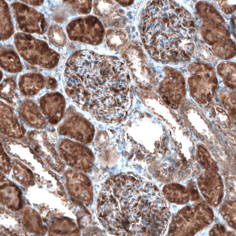 CAMTA1 Antibody - BSA Free Immunohistochemistry: CAMTA1 Antibody - BSA Free [NBP1-93620]