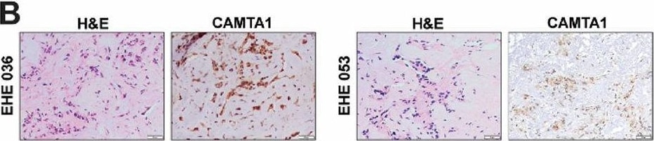 CAMTA1 Antibody - BSA Free